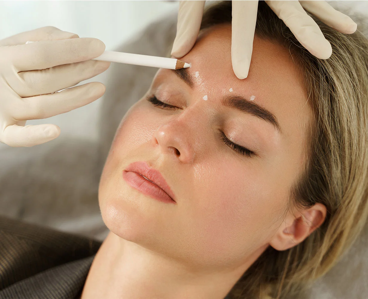 Provider marking injection points on a patient's forehead during an injectables consultation in St. Petersburg FL